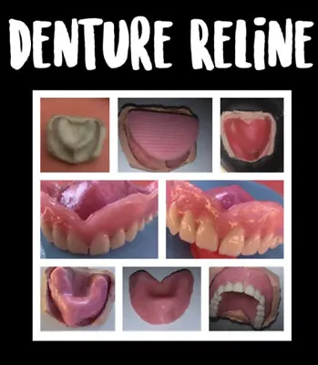 $30 • Buy DIY Denture Kit - Pink Gum Material & Polymorph For Denture Replacement/Reline