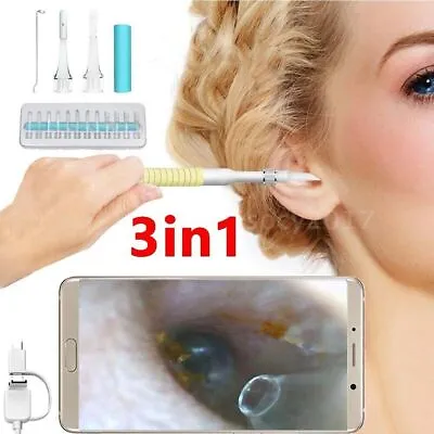 Digital LED Otoscope Ear Camera Scope Earwax Removal Kit Ear Wax Cleaning Spoon • £7.89