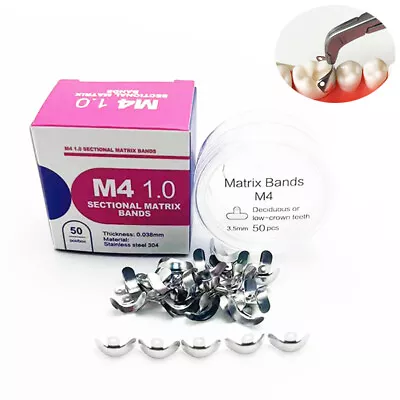 50Pcs Dental Matrix Bands Palodent V3 Sectional Contoured Metal Matrices Refill • $13.79