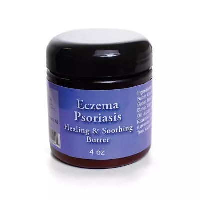 African Inport Eczema Psoriasis Cream Healing And Soothing Butter • $12