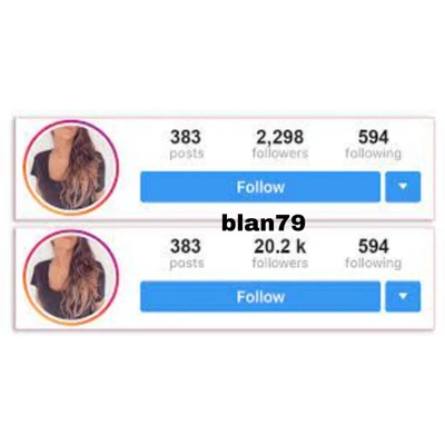 $4.95 • Buy Services For  Instagram Follow 1K - Fast Top Cuality 1-24H