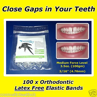Close Teeth Gaps Professional Orthodontic Elastic Latex Free Bands • £5.49