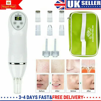Pro Diamond Microdermabrasion Vacuum Dermabrasion Skin Peeling Beauty Machine UK • £21.99