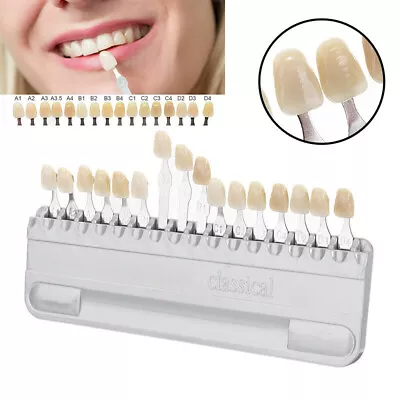 New Dental Bleaching Tooth Shade Guide VITA 16 Colors Teeth Whitening Comparison • $16.55