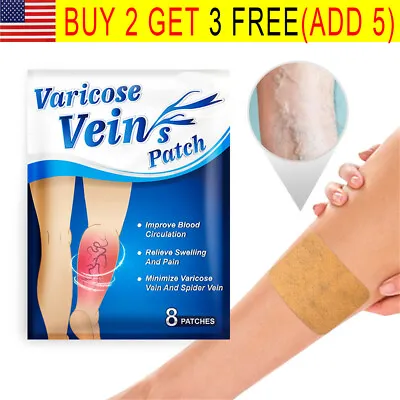 Varicose Veins Treatment Patches Plant Extract Relief For Vasculitis • $6.99