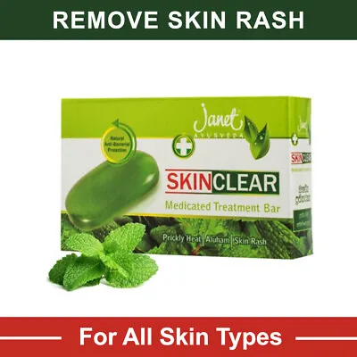 £12.91 • Buy Janet Ayurveda Skin Clear Medicated Soap Remove Pityriasis Versicolor, Skin Rash