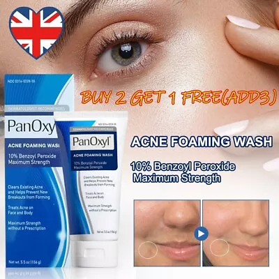 Acne Foaming Wash Face & Body 10% Active Ingredient 156g New UK 2024 • £7.99