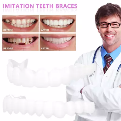 $12.99 • Buy Smile Veneers Snap On Upper Teeth Dental Veneers Dentures Tooth Cover White