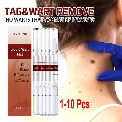 Common And Plantar Moles-Off Wartsoff Remover WipeOff Tags&Moles Remover US • $23.76