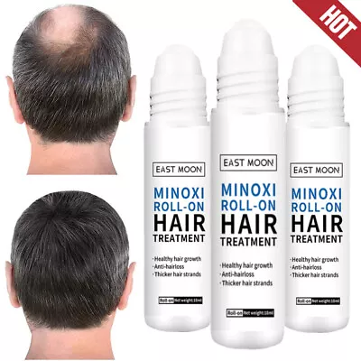 3 Pack Minoxi Roll-on Hair Treatment Extra Strength Hair Growth Serum Regrowth • £9.95