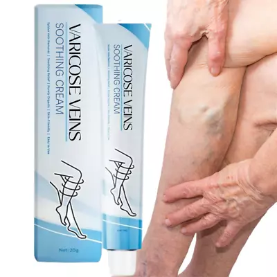 1/2/3X Varicose Veins Cream Varicose Veins Treatment Cream For Legs • £5.75