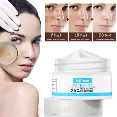 Strong Removal Melasma Whitening Cream Freckle Speckle Sunburn Spots Pigment • $9.94