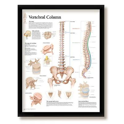 Vertebral Column Framed Medical Educational Poster & Frame 22x28 Wall Diagram • $65.99