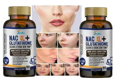 Best Glutathione Skin Whitening Pills Natural Anti Aging Supplement For Beauty 2 • $20