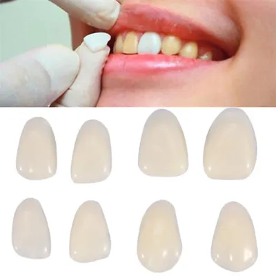 Ultra Thin Whitening Veneers Denture Patch Fake Teeth Gap Cover Temporary Repair • £7.79