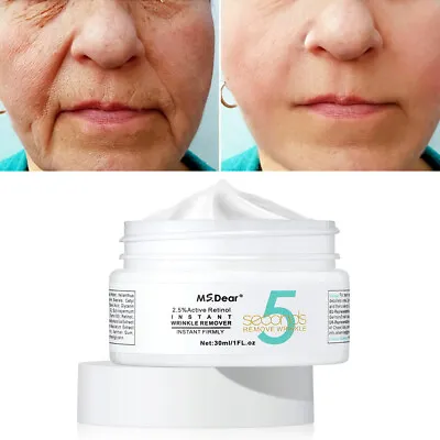 £7.95 • Buy Wrinkle Remove Instant Retinol Face Cream Skin Tightening Anti-Aging Eye Serum