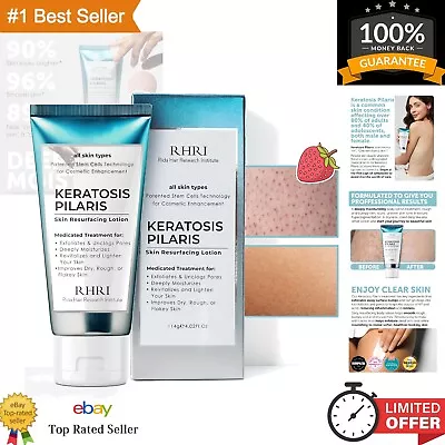 Keratosis Pilaris Lotion - Glycolic Acid Exfoliating Cream For Bumpy Skin - 4... • $34.99