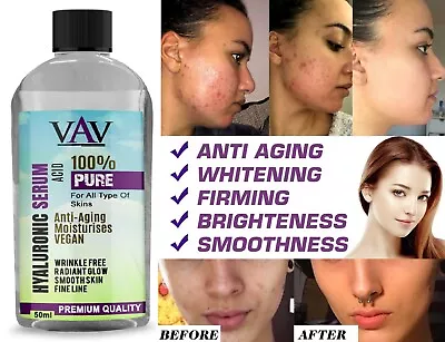 $12.05 • Buy Strong Anti Wrinkle Serum HYALURONIC ACID Ageing Collagen For Derma Roller 50ML