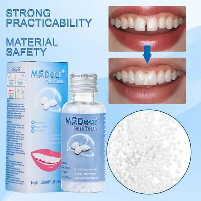 Temporary Tooth Repair Glue Kit For Missing & Broken Teeth Gaps Filler Moldable • £7.95