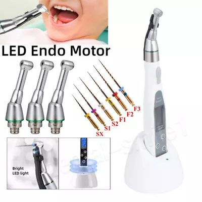 Dental LED Endo Motor Root Canal 16:1 Mini Contra Angle/Niti Rotary Files 25mm • $49.04