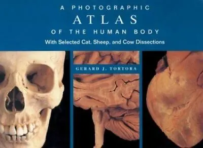 A Photographic Atlas Of The Human Body: With - 0471374873 Tortora Spiral-bound • $4.49