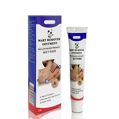 Wart Remover Face Body Arm Leg Wart Removal Cream Women Men Skin Tag Removi • £5.99