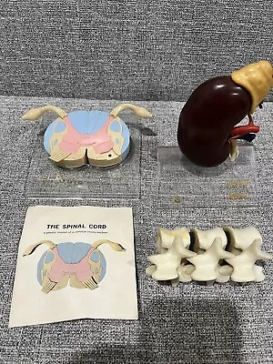 Merck 1960’s Sharpe Dohme Model Kidney Spinal Cord Vertebrae Elavil Aldomet MSD • $75