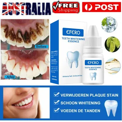 $12.95 • Buy Instant Tooth Whitening Kit White Teeth Clean Gel Uv Bleach Dental Strength Au