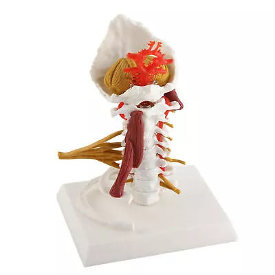 Cervical Spine Model Removable Human Spinal Nerves Model For Doctor Patient BOO • $46.49