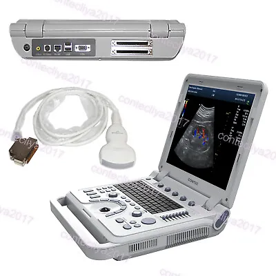 £3337 • Buy CMS1700A Portable Ultrasound Scanner Color Doppler Laptop Machine Convex Probe