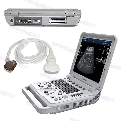 CMS1700A Portable Ultrasound Scanner Color Doppler Laptop Machine Convex Probe • £3337