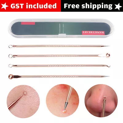 $3.99 • Buy Blackhead Black Head Extractor Remover Tools Pimple Comedone Acne Clip 4Pcs Set
