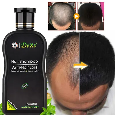 £9.45 • Buy DEXE Hair Growth Shampoo For Women Men Anti Hair Loss Treatment Care Thickening