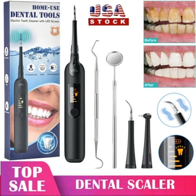 $22.18 • Buy Ultrasonic Electric Teeth Cleaner Dental Calculus Remover Scaler Tooth Cleaning