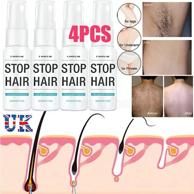 $15.98 • Buy 4xNatural Permanent Hair Removal Spray Stop Hair Growth Inhibitor Remover Smooth
