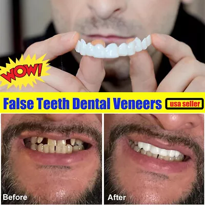$7.89 • Buy  Smile Snap On Upper＆Bottom Set False Teeth Denture Veneers Dental Tooth Cover