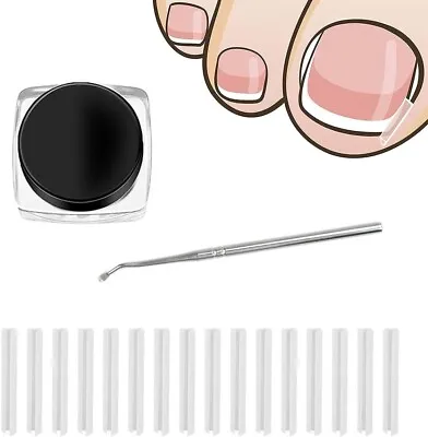 Toenail Correction Patches Recover Clips Kit With Nail Clippers For Ingrown Toen • £5.76