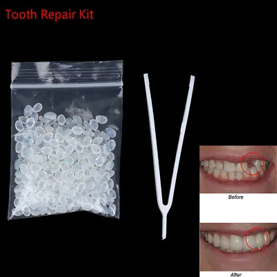 10g Denture Adhesive Temporary Tooth Cosmetic Repair Kit Teeth Gaps Solid Gl:da • £3.42