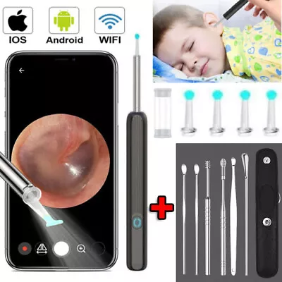 Wireless Ear Wax Remover Cleaner Camera HD Endoscope Scope Pick Removal Tool Set • £3.58