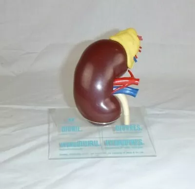 Vtg 1961 Anatomical Kidney Doctors Office Model Merck Diuril Advertising • $34