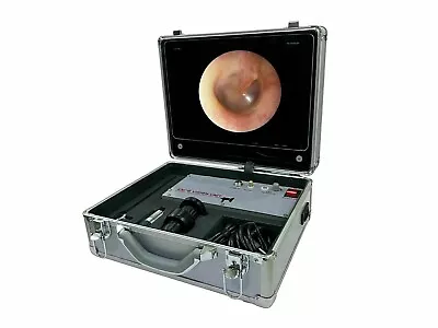 Portable Endoscopy Unit Video Endoscopy System Endovision ENT Medical Device Set • $934.58