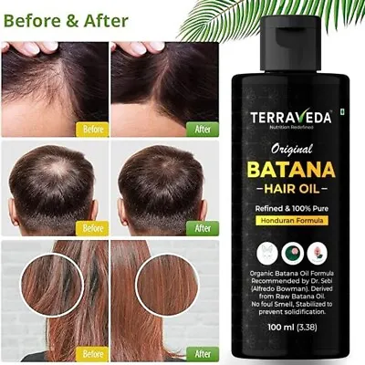 Dr Sebi Organic Raw Batana Oil From Honduras For Thicker & Stronger Hair Growth • £17.66