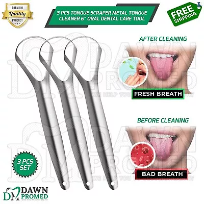 3 Pcs Tongue Scraper Metal Tongue Cleaner 6  Oral Dental Care Inst German Grade • $14.20