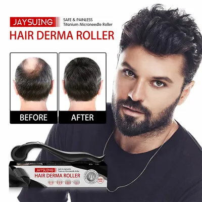 $4.38 • Buy 1PC 540 Derma Microneedle Titanium Roller For Hair Beard Growth Anti Hair LoYA
