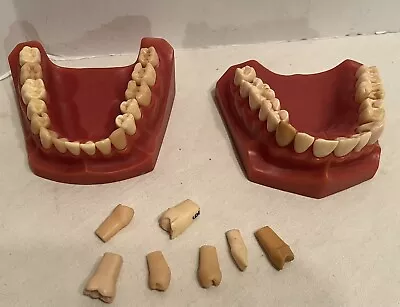 Vintage Large Dental Tooth Model Educational Teeth Display For Dentists • $29.95