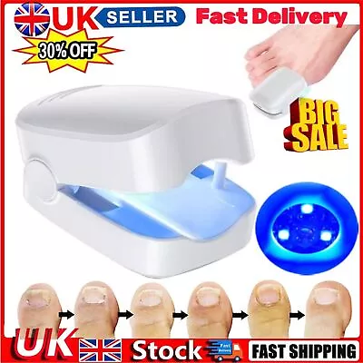 Nail Fungus Laser Device Light Therapy Onychomycosis Toes Treatment 100% New • £10.99