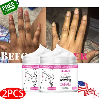 $13.45 • Buy 2 PACK Dark Skin Permanent Bleaching Cream Body Whitening Lightening Brightening