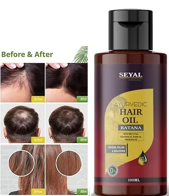 Batana Hair Oil Hair Growth Oil With Shikakai Argan Oil & Rosemary 100% Pure • $17.99