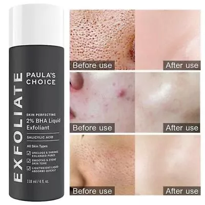 £9.28 • Buy PAULA'S CHOICE NEW 118ml - SKIN PERFECTING 2% BHA LIQUID EXFOLIANT UK New SEALED