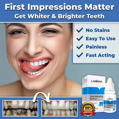 New Instant Tooth Whitening Kit White Teeth Clean Gel Uv Bleach Dental Strength • $24.95